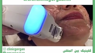 بهترین روش های جوانسازی پوست (هایفوتراپی)