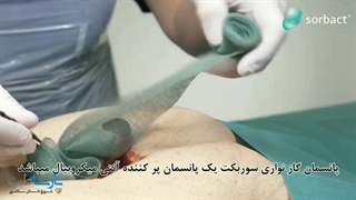 پانسمان گاز نواری سوربکت