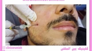 روشی ساده برای لاغری صورت