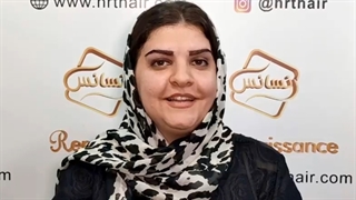 کاشت ابرو