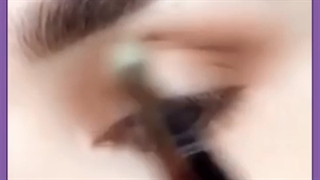 چه کسانی نباید لابیاپلاستی انجام دهند؟