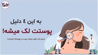 علت انواع لک پوستی برداشتن زگیل