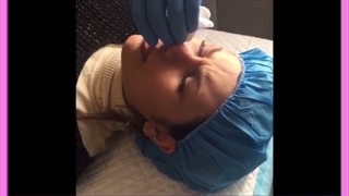 هزینه مزایا لیفت بینی با نخ