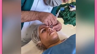 بلفاروپلاستی و چشم گربه ای توسط دکتر علیزاده