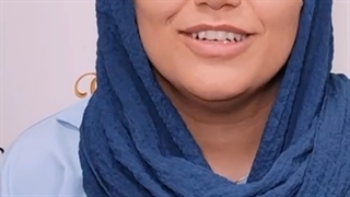 کاشت ابرو