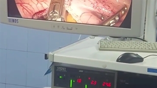 افرادی که پس از جراحی چاقی قصد فرزند آوری دارند کدام نوع عمل را انتخاب کنند؟