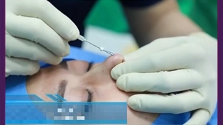 ماندگاری لیفت بینی چقد راست؟