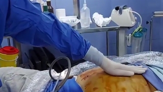 نحوه محاسبه bmi