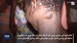 آبله میمون در وضعیت اضطراری جهانی