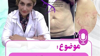 کربوکسی تراپی منافذ باز پوست