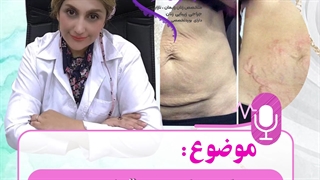 کربوکسی تراپی ترمیم لبخند لثه‌ای