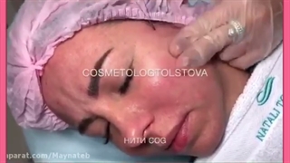 همه چیز در خصوص لیفت با نخ از مزایا عوارض و هزینه ها