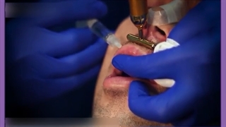 کل فیلرها در زیبایی چیستند؟