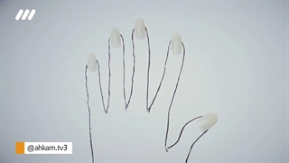 احکام کاشت ناخن ...   و نماز و وضو با آن