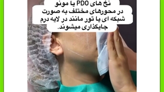 لیفت صورت در همدان
