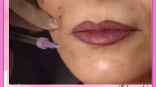 زیباسازی صورت با موارد طبیعی