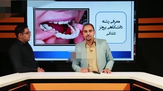 رشته پروتز دندان بدون کنکور