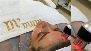 جوانسازی صورت با آراف اصلاح طرح لبخند