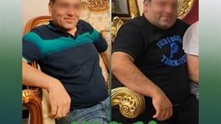 قبل و بعد جراحی اسلیو معده