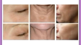 افرادی که کم کاری تیروئید دارند هایفو واسشون خطرناکه؟