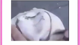 روش های مراقبت از دندان مصنوعی