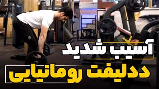 آسیب شدید ددلیفت رومانیایی romanian deadlift