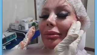 بهترین انتخاب عمل زیبایی صورت