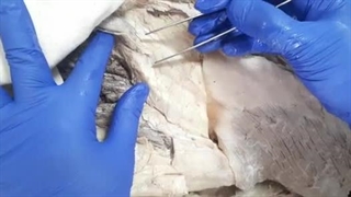 فیلم تشریح کانال مغابنی در انسان