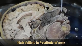 فیلم آناتومی سر و گردن انسان