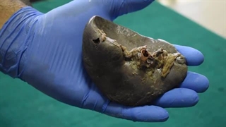 فیلم آناتومی و تشریح طحال انسان-مهدی محمد حسین زاده