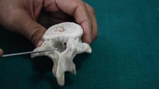 فیلم تشریح مهره های انسان-قسمت 1-مهدی محمد حسین زاده