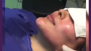 ماندگاری چربی در پوست چقدر است؟ بلیچینگ دندان