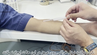 بهترین تکنیک برای خون گیری | جمشیدیان هلث