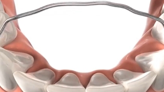 درمان طولانی تر باعث بهبود نتیجه درمان خواهدشد؟دکترخدیوی متخصص ارتودنسی