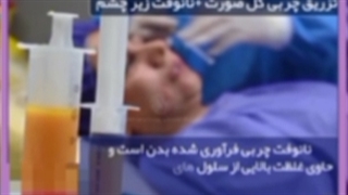 تزریق چربی به روش نانو فت چگونه انجام می شود؟ پاکسازی پوست
