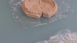 آماده سازی قالب های ارتوسرجری