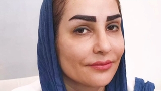 کاشت ابرو