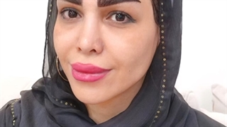 کاشت ابرو