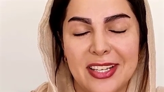 کاشت ابرو