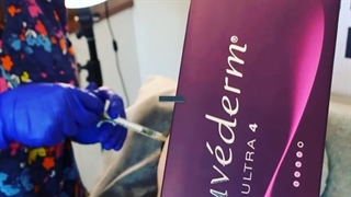 تزریق فیلر درنقاط لیفت گونه درمان ریزش مو