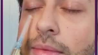 روش های درمان پف زیر چشم