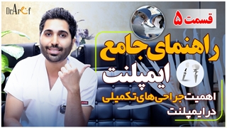 انواع جراحی های تکمیلی برای انجام درمان ایمپلنت | قسمت پنجم