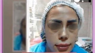 مزایای تزریق چربی چیست؟