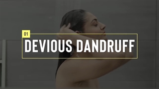 بهترین روش درمان شوره سر