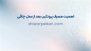 اهمیت مصرف پروتئین بعد جراحی چاقی