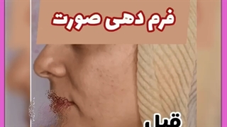 مهترین مراقبت های لازم جهت جلوگیری از پیر شدن پوست