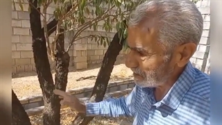 (تجربه پیر باغدار نجف آبادی) بلیچینگ دندان