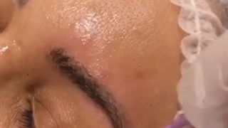 ریمو تاتو بدون آسیب رشت