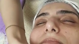 آخرین مرحله فیشیال ماساژ تخصصی صورت