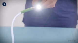 تشریح کامل فرایند جراحی لاپاراسکوپی؛ جراحی‌ای کم‌عارضه و موثر